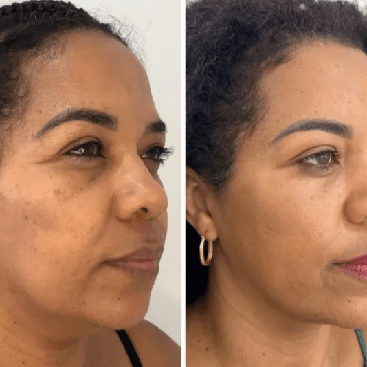 Ingredientes de la mascarilla Collagen Fit