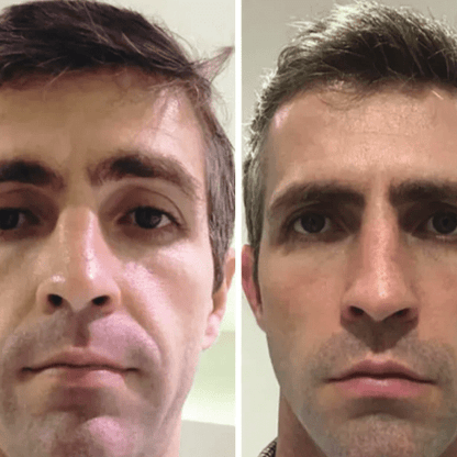 Modo de uso de la mascarilla peel-off